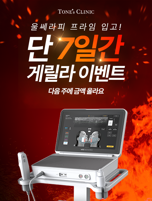 팝업